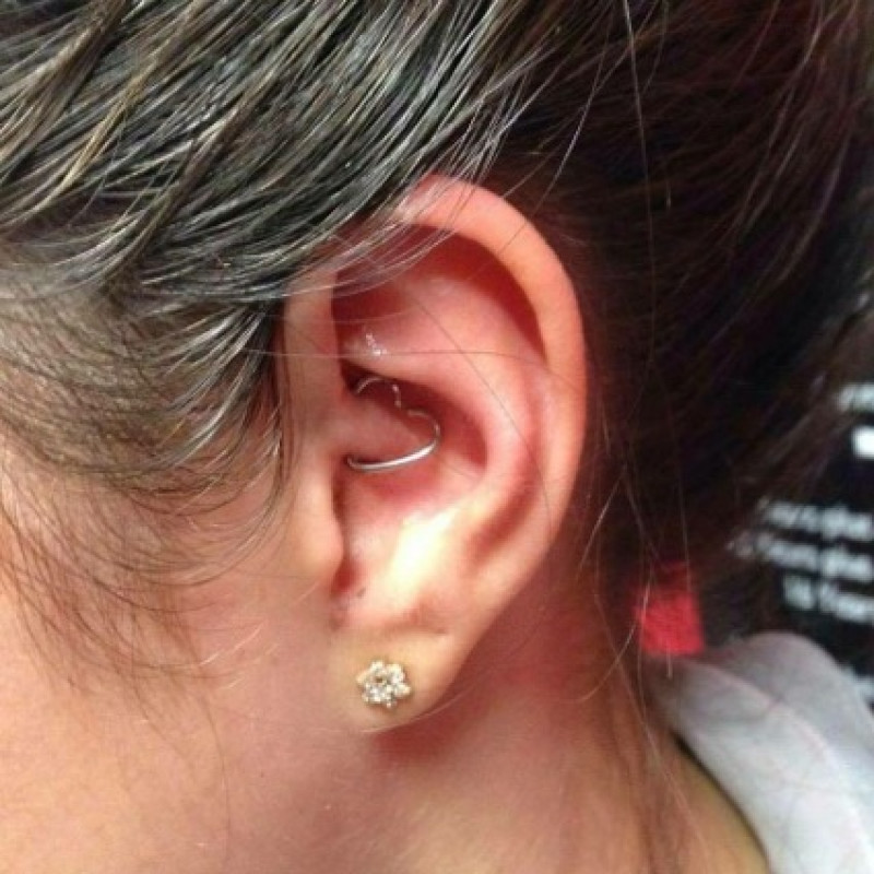 Main image for Unusual clients try piercing for migraine cure