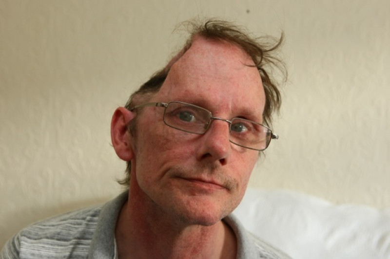 Main image for Father left with serious health problems following stroke told he’s fit for work