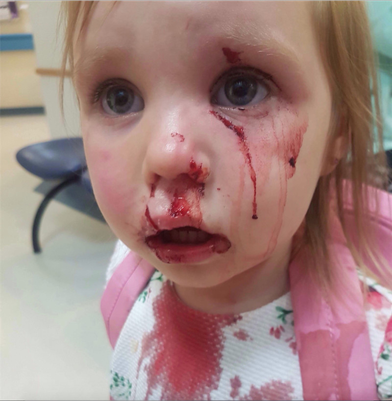 Main image for Girl left with scars for life after attack